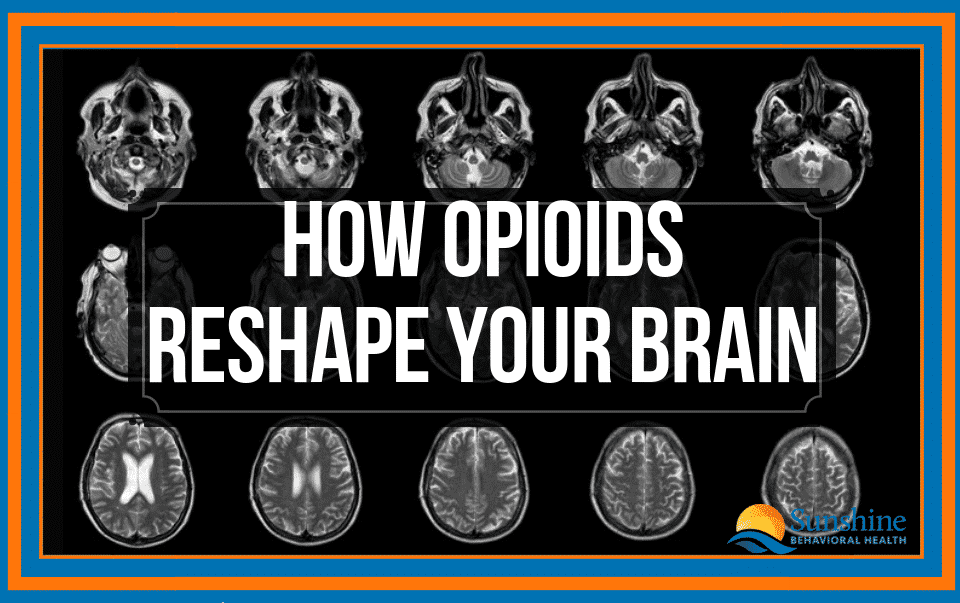 How Opioids Reshape Your Brain